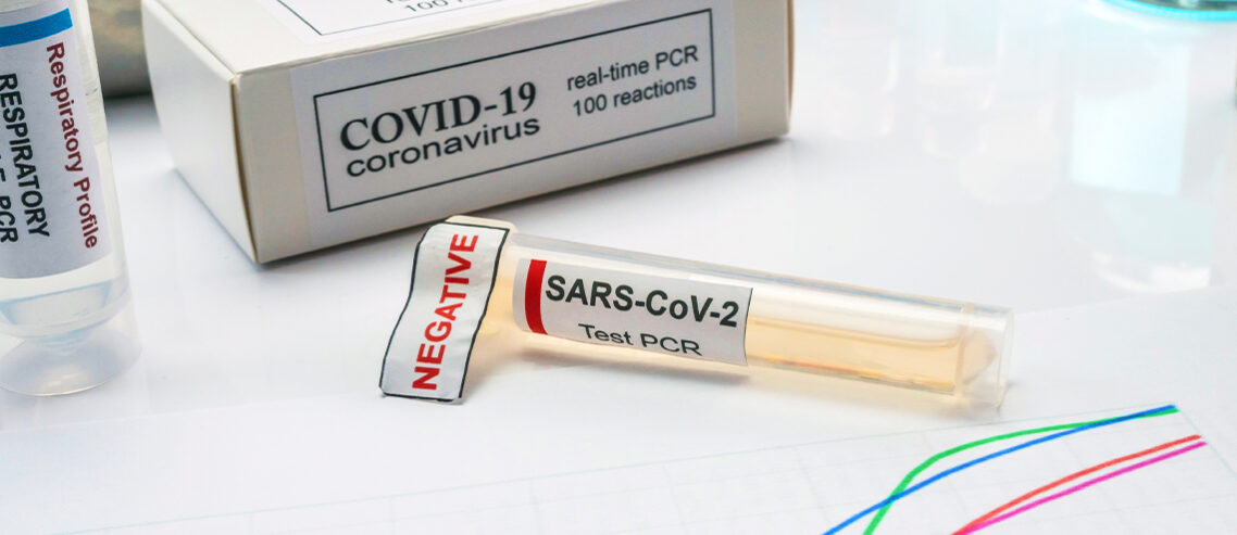 RT-PCR