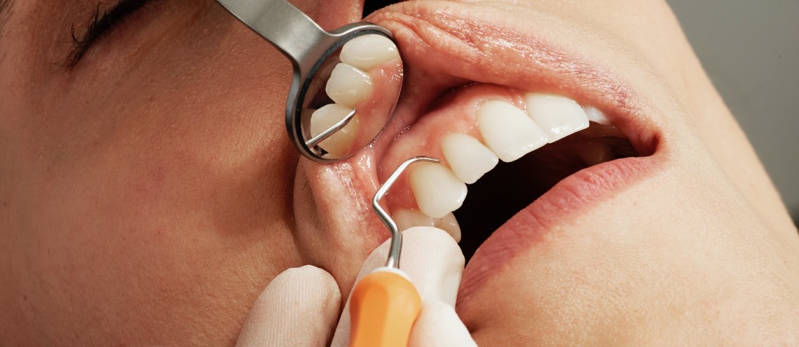 Close up of teeth examination with mirror and pick - dental care 