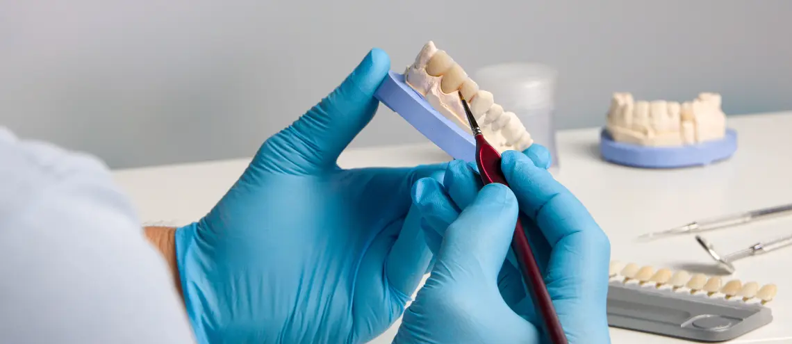 Dental Crown_Type