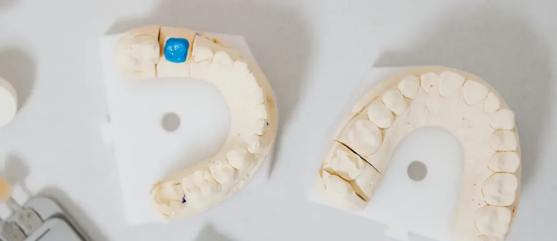 Dental Crown Treatment in Thailand